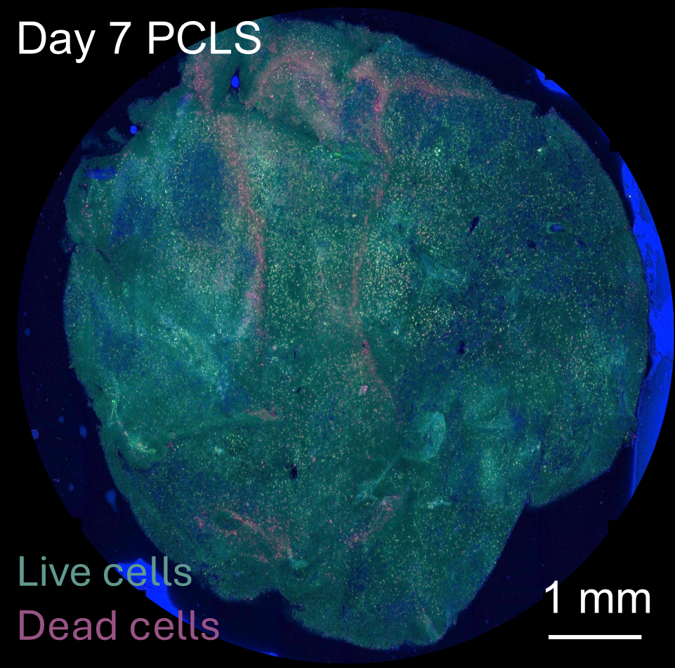 PCLS_imaging